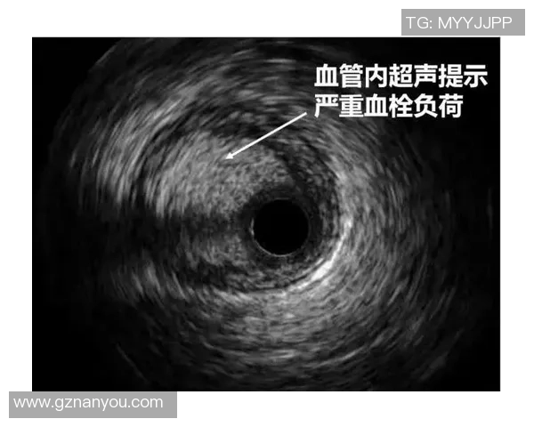 足球球星心梗危机引发健康警示运动员需关注心脏健康问题